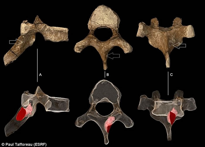 南非出土古人类化石证人类170万年前已患癌症