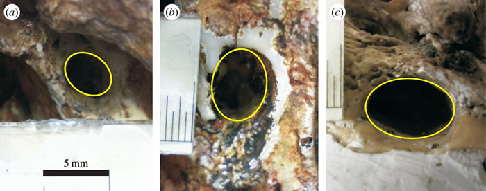 脑洞大开:人类头颅中让两条主动脉通往大脑的洞300万年来扩大了6倍