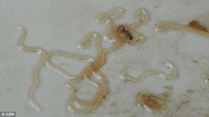 恶心:波兰男子超市买鲭鱼回家 发现鱼肚内满布大量蠕动寄生虫