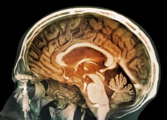 英国研究发现空气中磁性纳米微粒能进入人类脑部 或增患脑退化症风险