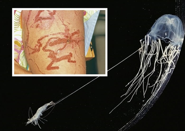 被箱型水母刺中,后果不堪设想。