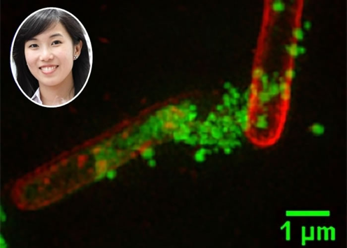 林舒(小图)的团队研发的星形蛋白(绿),可以撕裂超级细菌(红)的细胞壁,从而杀死它们。