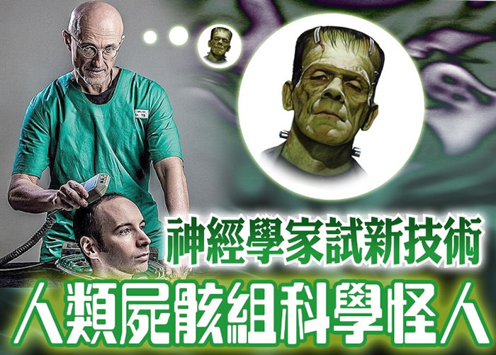 卡纳韦罗打算以脑干死亡的人类尸骸测试新技术。