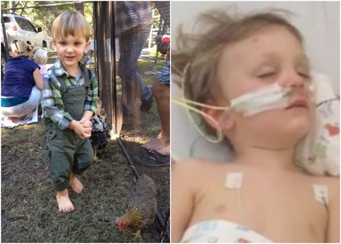 伊莱被毒蛇咬后,奇迹生还。