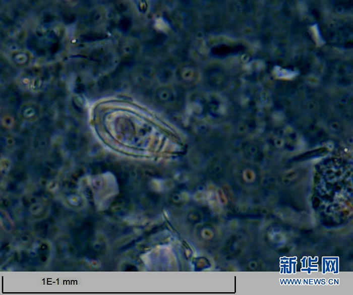 Ž֪٣׺ɣＸǨڷŴ1000౶΢£ġϵĿѧҶ˴ϺȡоС΢硱ԡ»緢 㣩