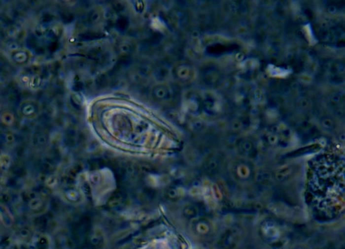 ڷŴ1000౶΢£ġϵĿѧҶ˴ϺȡоС΢硱ԡ»緢 㣩