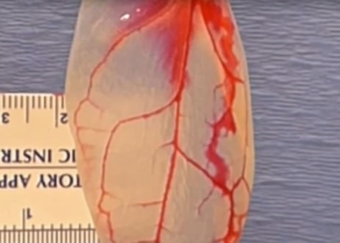 菠菜叶拥有与心脏血管相似的结构。