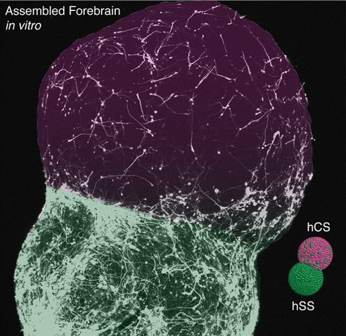 状态如同数月大人类胚胎的大脑。