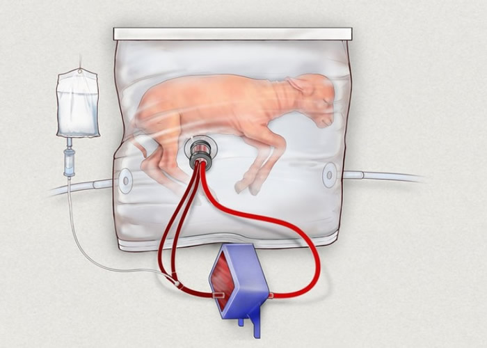 该款人造子宫模拟子宫内环境。