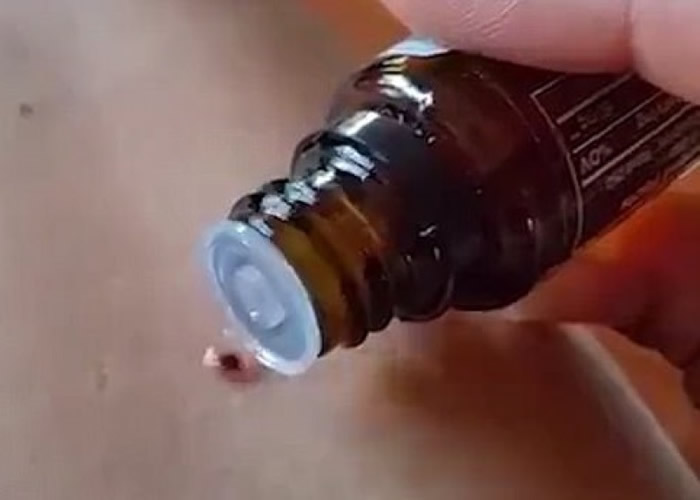 片中女子示范以薄荷油,令附在身体上的蜱虫脱落。