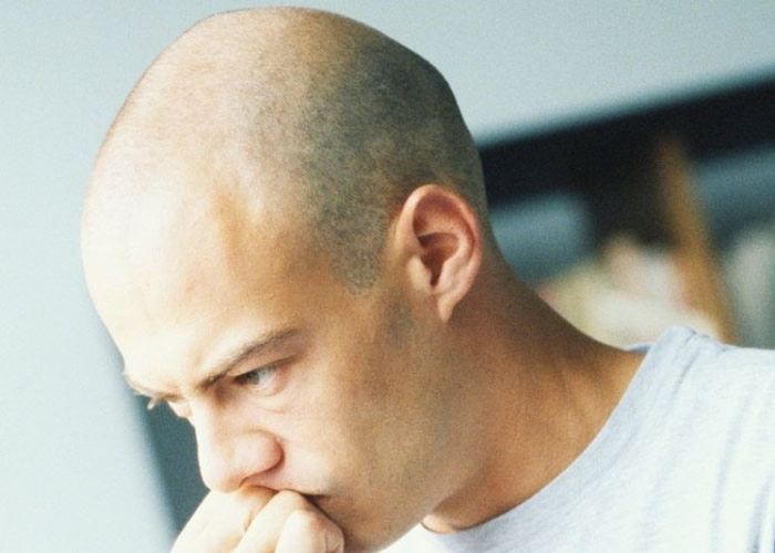 秃头者福音!美国加州大学科学家发现免疫细胞Tregs刺激毛发生长