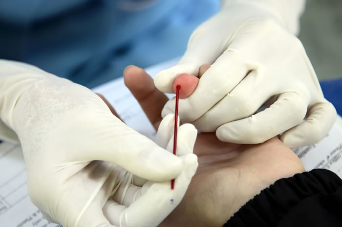 ���ƶ�ͯ��Ӫ����ȱ����ƶѪ