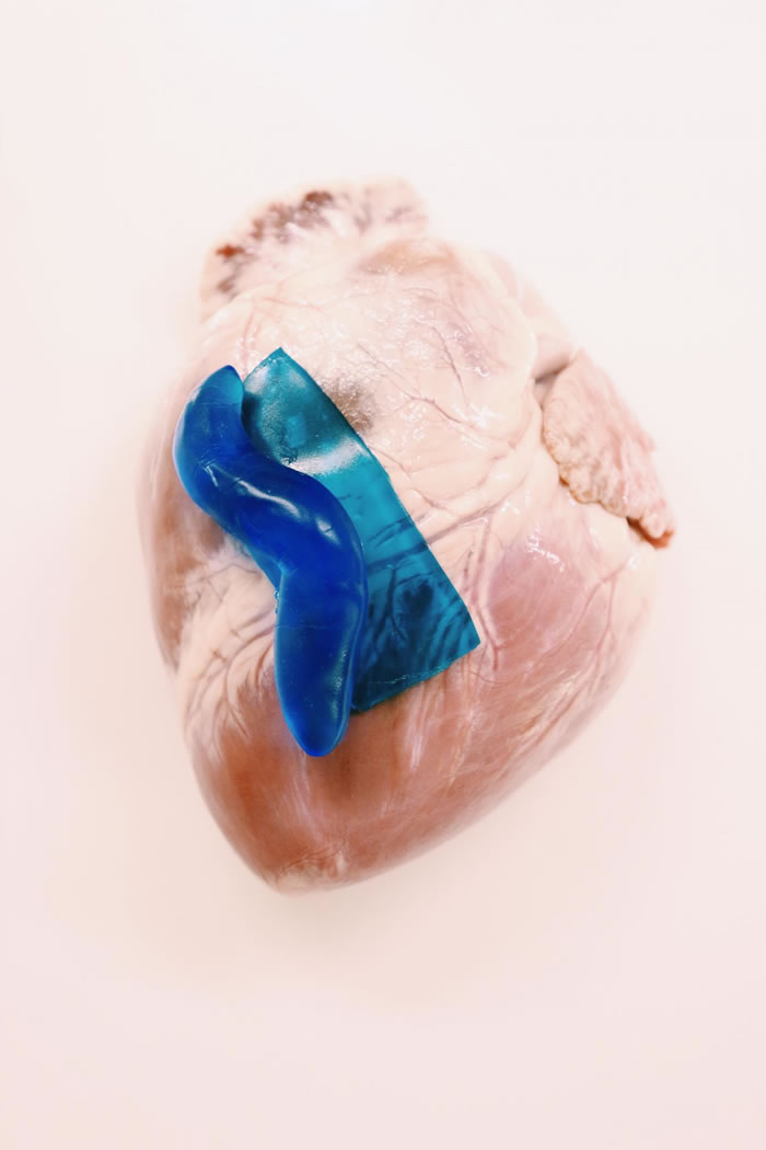 受蛞蝓粘液启发的用于封合伤口的新型手术黏胶