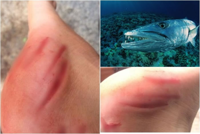专家相信是是梭子鱼(右上)咬伤日本男游客。