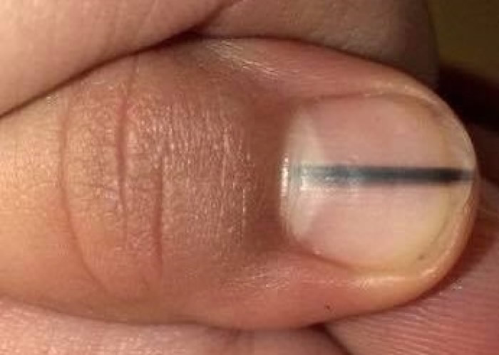 ����ʦ���ֿ���ָ����һ����ɫֱ�� ԭ����Ƥ�����еĺ�����ɫ����