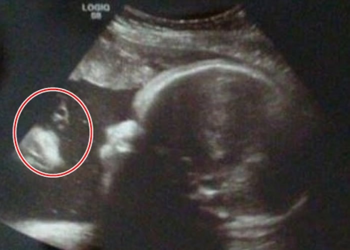 ������ͼƬ�г���ò��Ү�յ�ͼ������Ȧʾ����