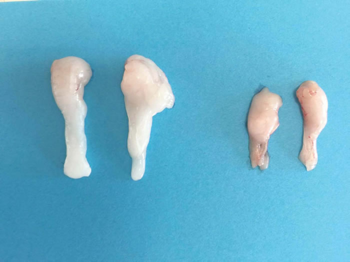 ��ʲô�����ա�֬���ͳ���΢������ϵ��һ��