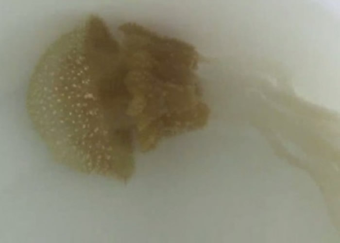 箱型水母威胁游客安全的问题,一直未解决。