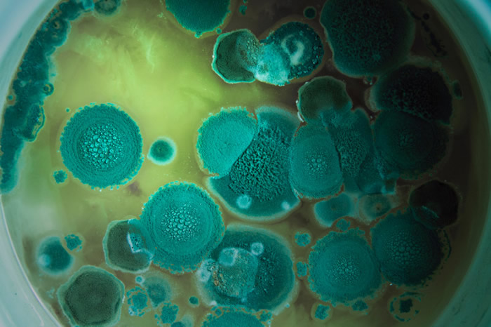 免疫细胞可通过触发真菌孢子自杀而中止真菌感