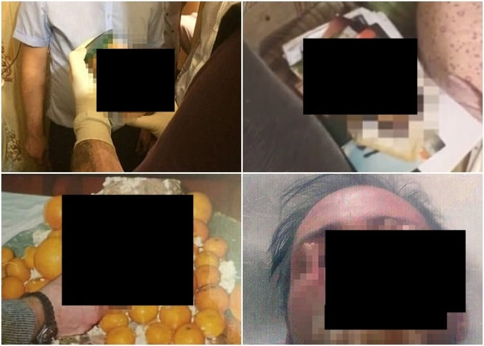 警方发现疑似人头(左上),以及用瓶子装着的残肢(左下)。现场有疑犯玩弄头颅照(右上),网上并有疑为疑犯口咬残肢的照片(右下)。