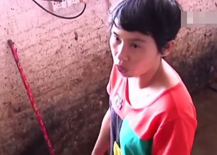 被“蛇头”咬伤的妇人讲述事发时的经过。