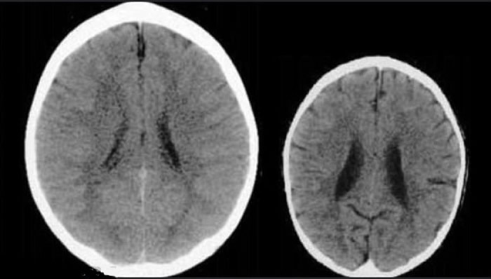 �о��ɶ�ͯ����ѧ��¬�ȣ��ң��쵼���С�