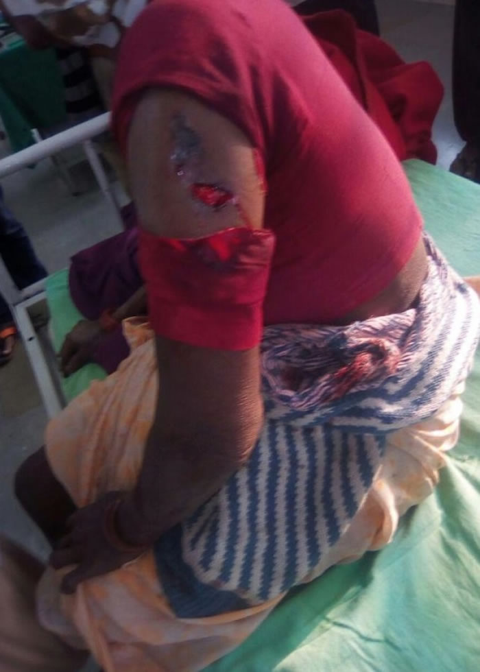 ��ά���ֱ������ϻ�ץ�ˡ�