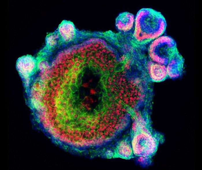 ��Ƥ�����ڼ������Ұ�����壬Ȼ����Ƥ���Χ��������