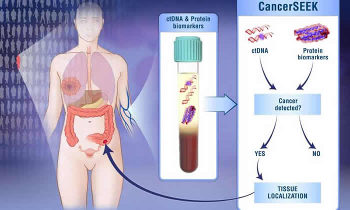 Լ��.���ս�˹��ѧKimmel��֢�о����ģ�һ��ѪҺ���ɸ��������Ͱ�֢