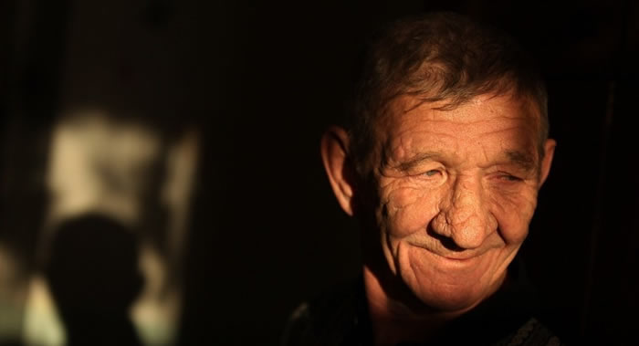 ÿ�����뽪�����������ƽ����˵ļ����� ��������մ�֢