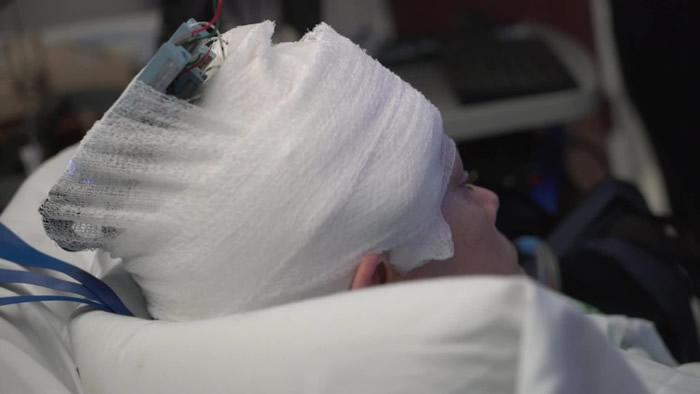 ��ѧ���״��Բ��˵���ϸ�������ģʽ�ؽ�����ʧȥ�ļ��䡣