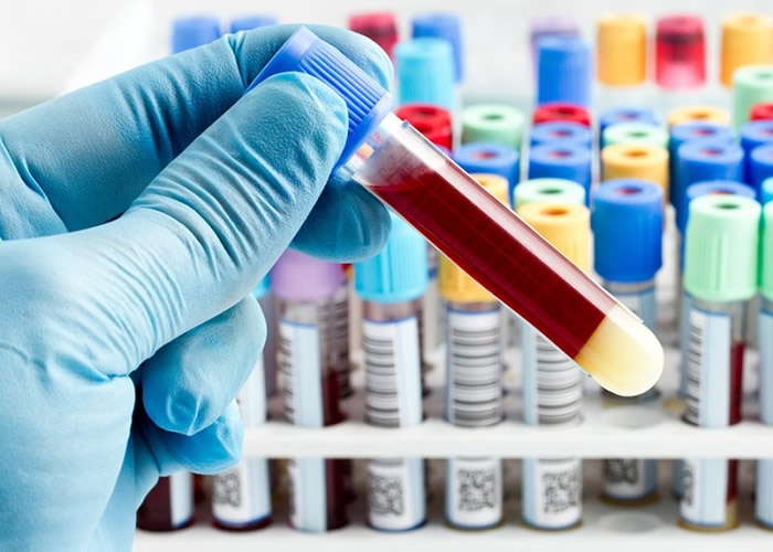 ��Ѫ�·�����Ϊ��Ⱙ֢�����ش�ͻ�ơ�