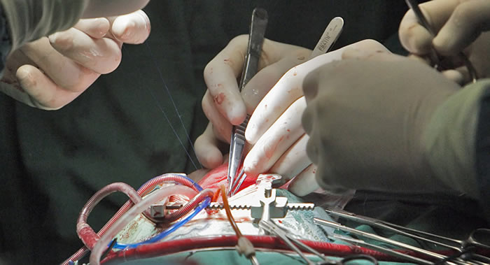 天气寒冷增加心脏病突发和心肌梗塞的可能性