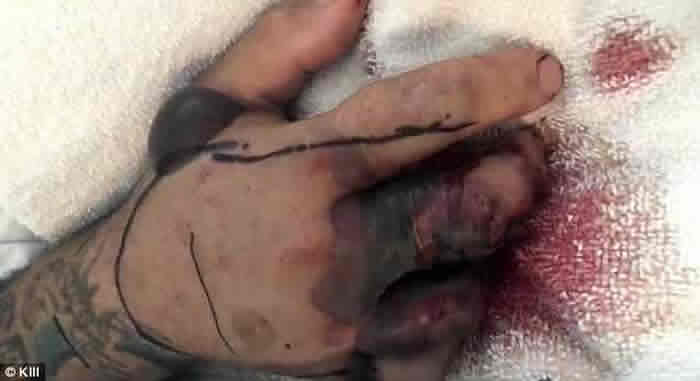 ��ͷ�߹����ˣ������������ӿ�����β�ߵ�ͷ ����ϵ�����ͷ��ҧ����