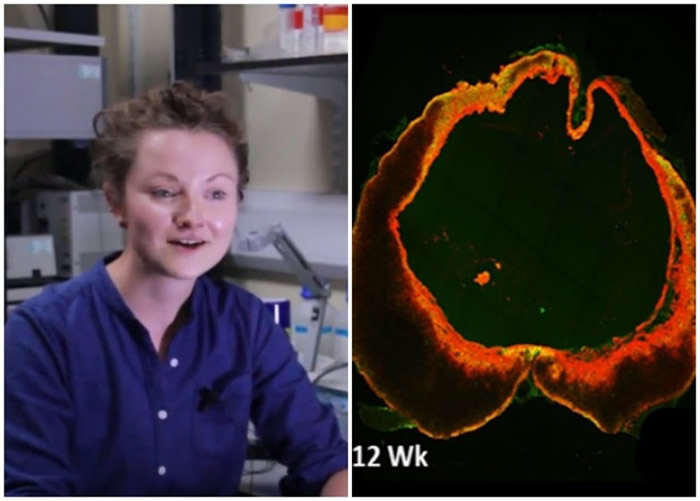 伯恩塞德(左图)研究基因疗法,让脊椎受损老鼠的脊髓细胞自我修复。
