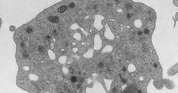 日本成功利用诱导多功能干细胞制成大量血小板