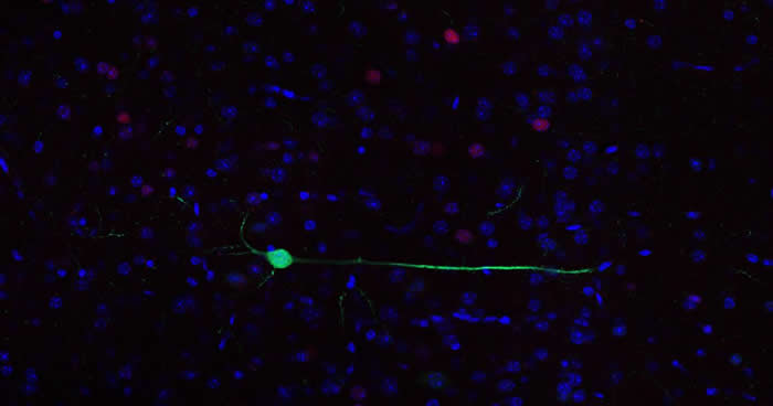 每张图中的绿色部分，都代表被萤光蛋白标示出「标记」记忆的地方。 PHOTOGRAPH BY STEPHANIE GRELLA