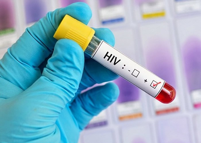 ôרҷֱֵHIVһڷ