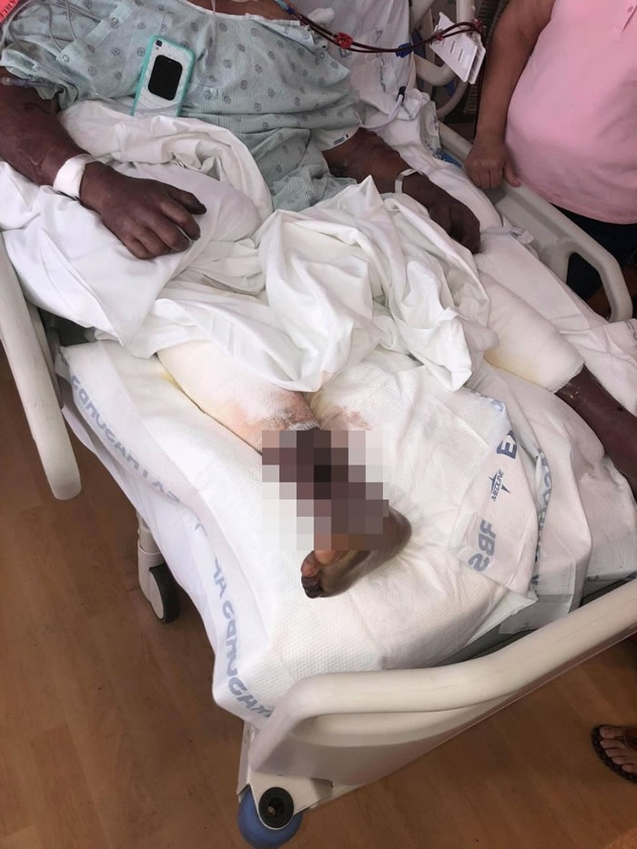 ����˹����֫��ʼ���ͱ�ɫ��