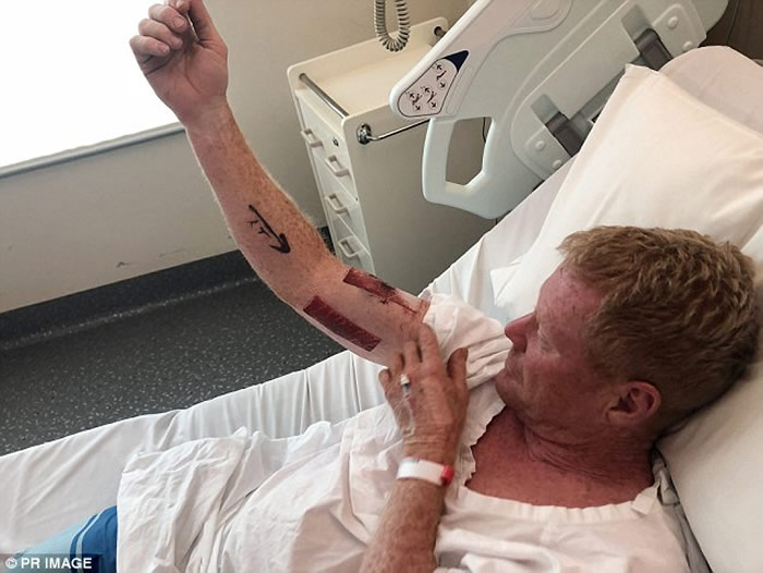 澳洲冲浪客清晨冲浪时遭鲨鱼攻击 挥拳反击自救