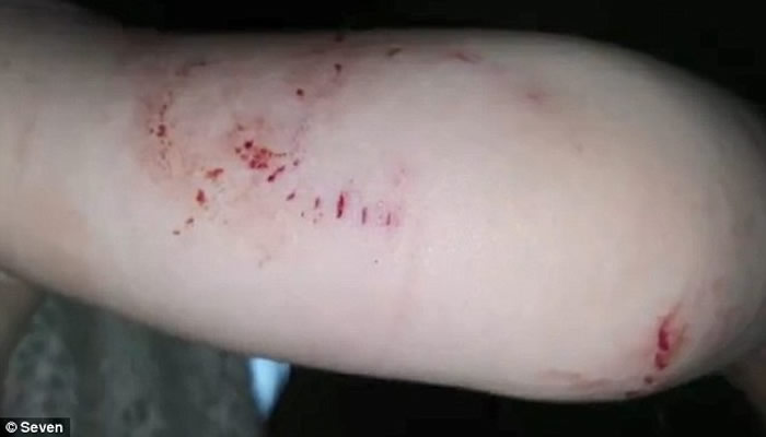 ������ʿ��22���´���ͯ�ڼ��б����߲�ס��㱻���¶� �⹫��ʱ��������ͷ����