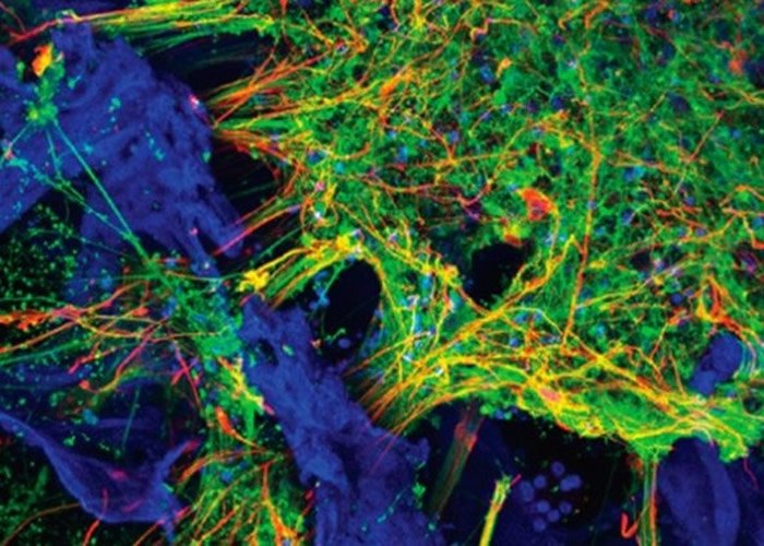 塔夫斯大学研制首个以活人干细胞3D打印大脑组织。