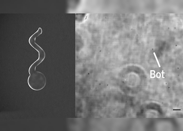 “微型推进器”状似蝌蚪,可进入眼球。