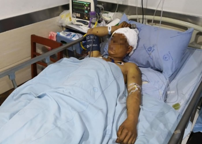 �Ĵ����������ӵ�ɽ������¶ʱ�����Ϯ��������ҧ��