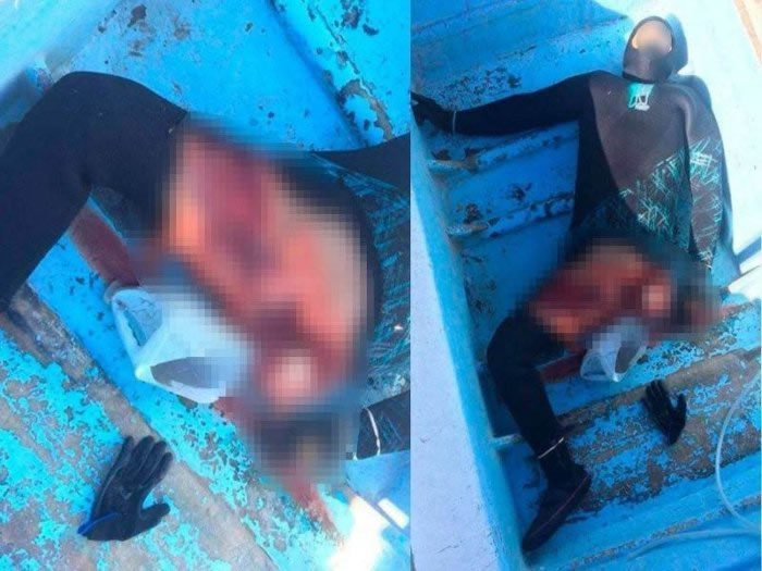 墨西哥男子潜水不小心跳到鼬鲨身上 整个生殖器和腹部都被鲨鱼咬掉