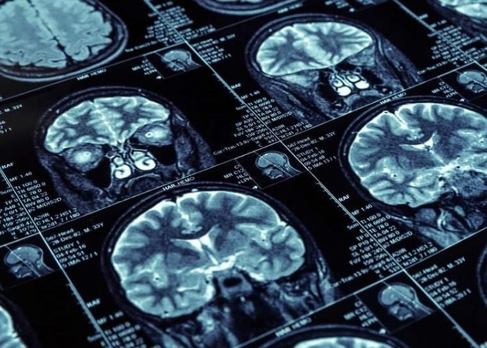 Ӣ�����򱤴�ѧ�о���Ա���ַ�����ʿ���Խṹ������������ʿС