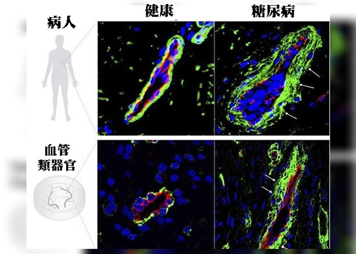 研究团队透过技术测试糖尿病药物。