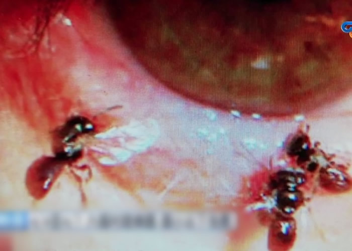 ȫ��������̨�����Ů��ȥɨĹ�����۾���ʹ ԭ������4ֻ����