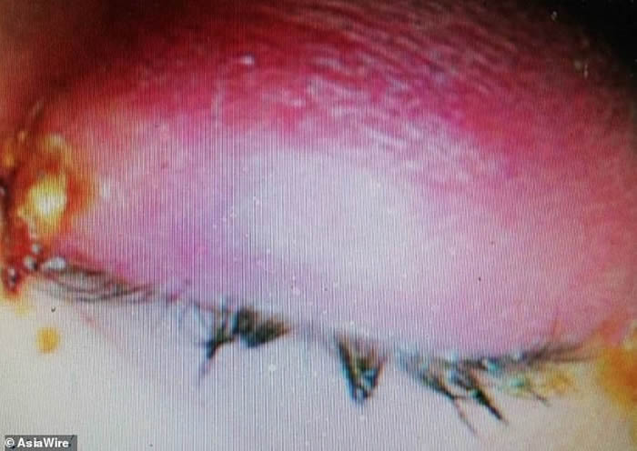 ȫ��������̨�����Ů��ȥɨĹ�����۾���ʹ ԭ������4ֻ����