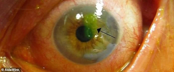 ȫ��������̨�����Ů��ȥɨĹ�����۾���ʹ ԭ������4ֻ����